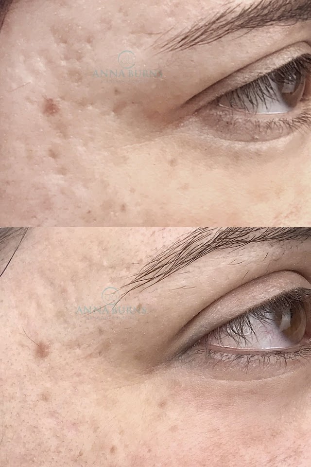 Anna Burns Permanent Cosmetics photo 2