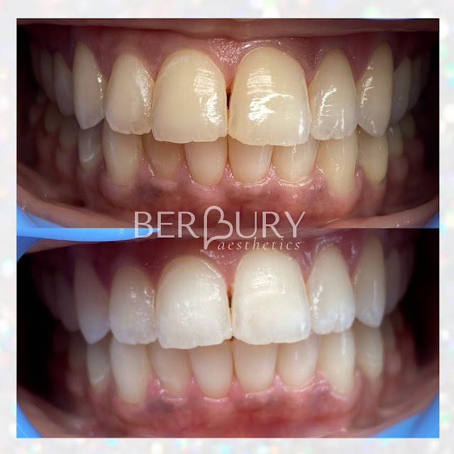 Berbury Aesthetics photo 2