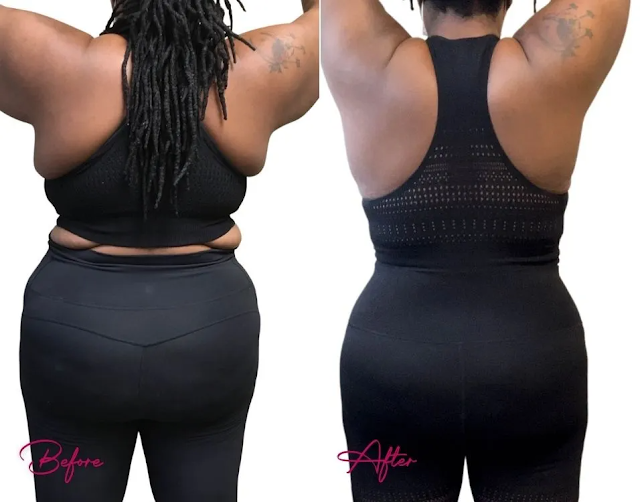 Body Esthetics: Dr. Lissa Plastic Surgery photo 2