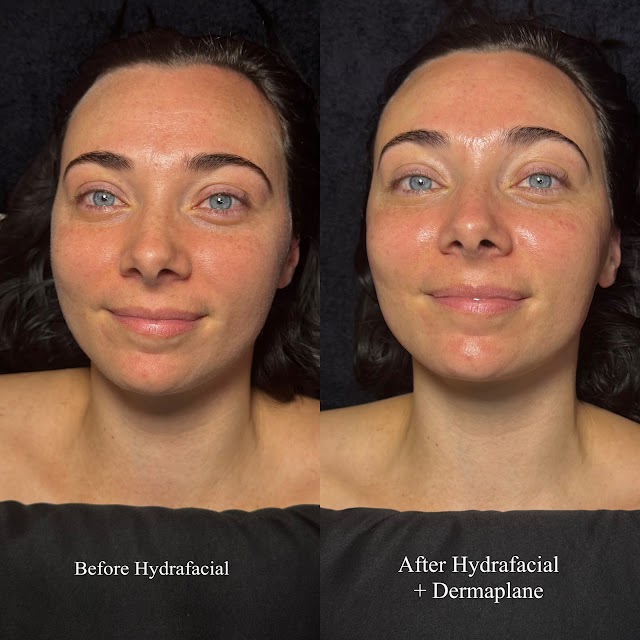 Dermalani Skin | Body Sugaring + Brazilians + Custom Facials photo 4