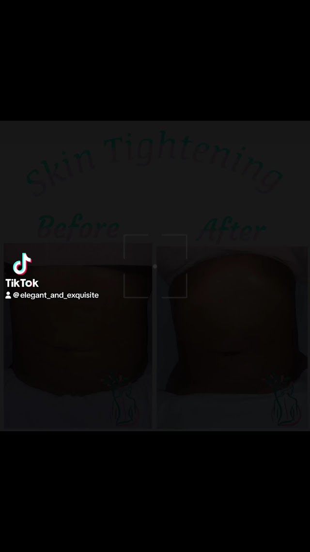 Elegant And Exquisite Massage & Esthetics LLC photo 3
