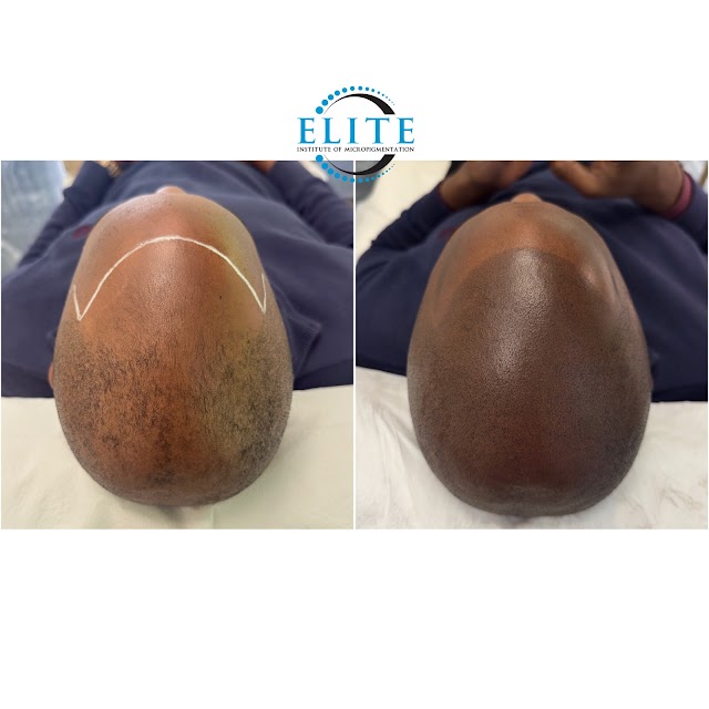 Elite Institute of Micropigmentation Atlanta photo 2