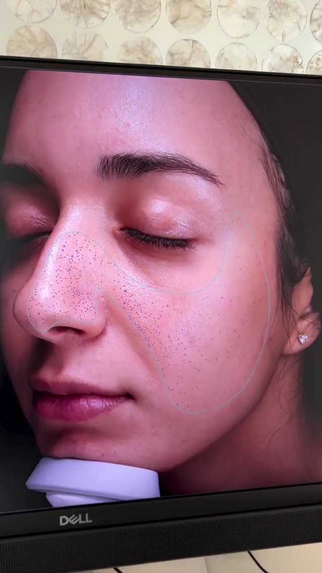 ELLEMES Medical Spa photo 2