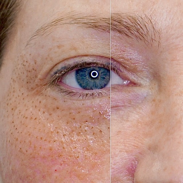 ELLEMES Medical Spa photo 3