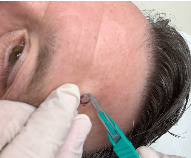 Gaughf Dermatology photo 2