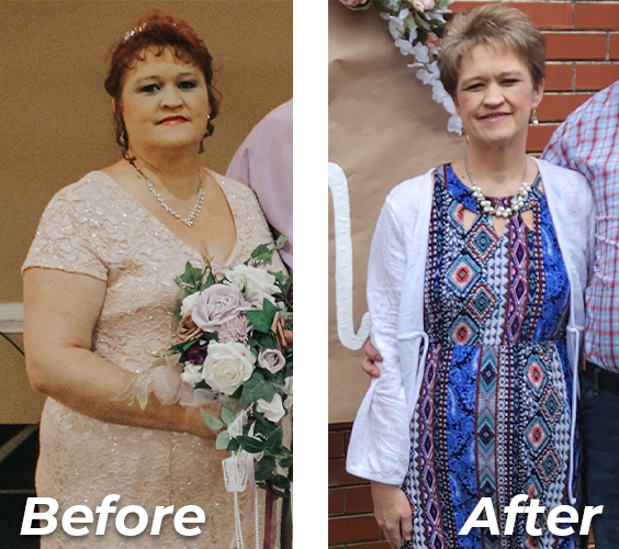 Huntsville Weight Loss photo 2