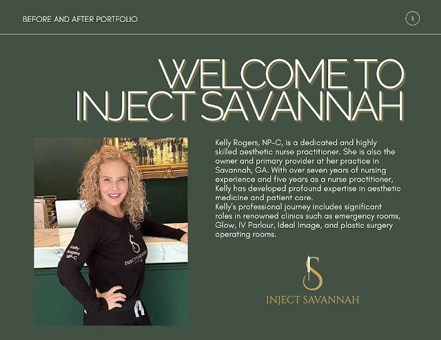 Inject Savannah photo 2