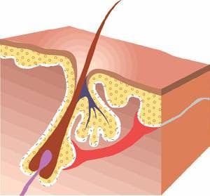Silk Electrology and Esthetics photo 2