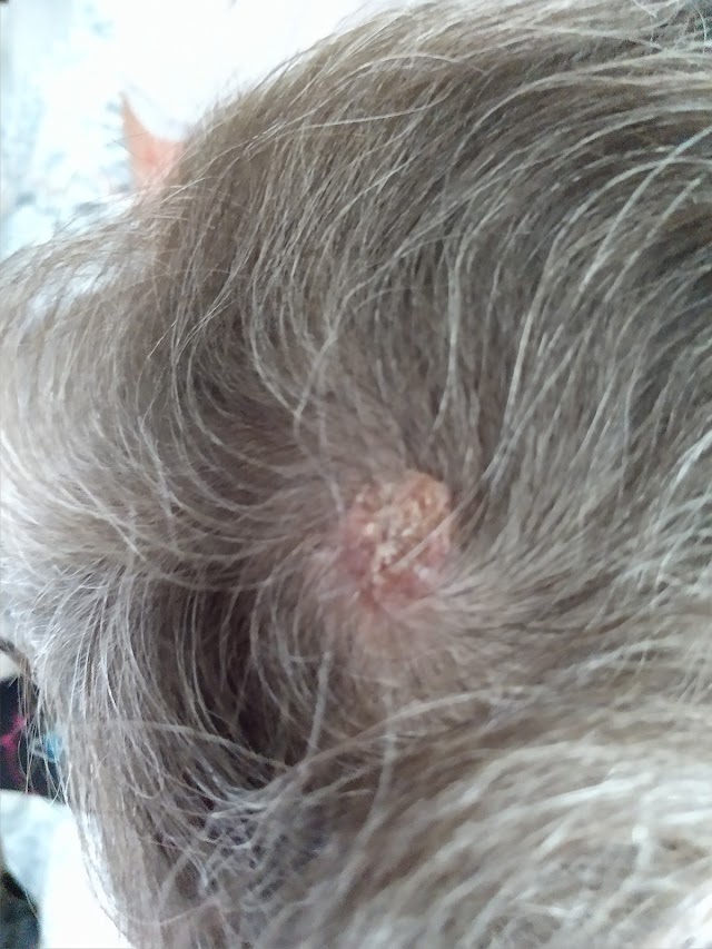 Southern Skies Dermatology and Surgery photo 3