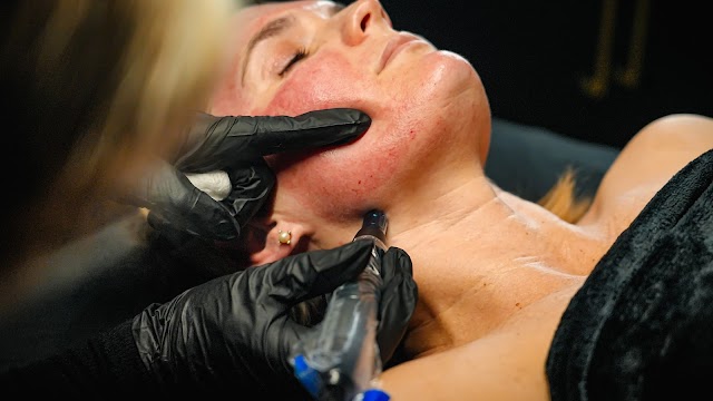 Tox Medspa by Nurse Dallas photo 4